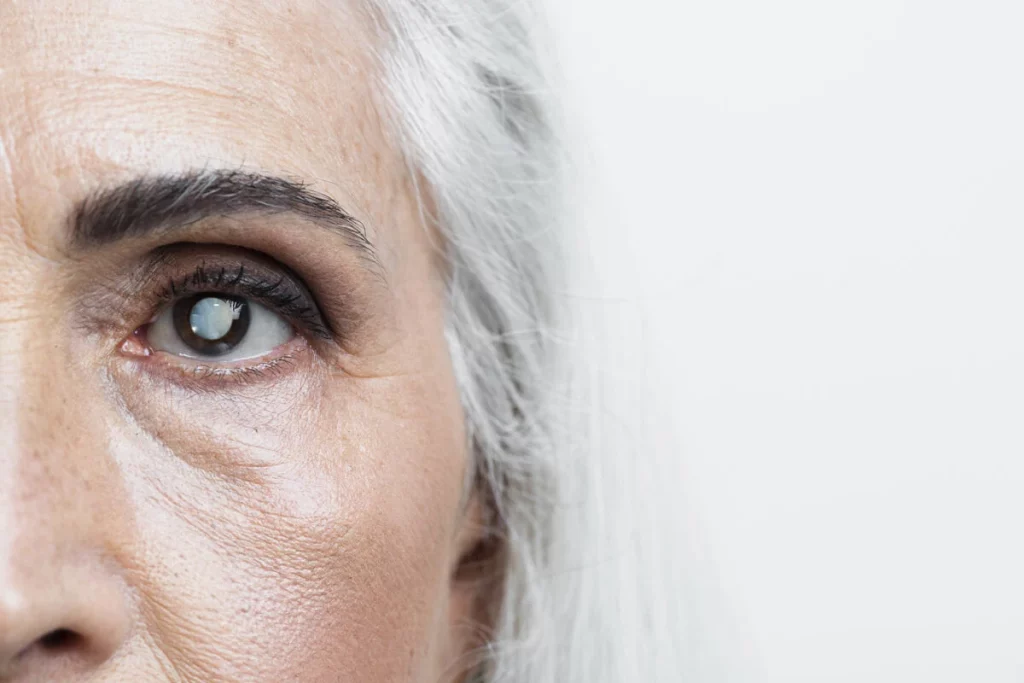 Retinitis Pigmentosa (Tavuk Karası)